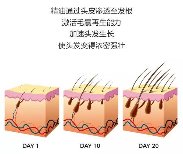 剃光头可以增加发量吗，剃光头增加发量可行吗（女博士剃光头研发精油洗发水）
