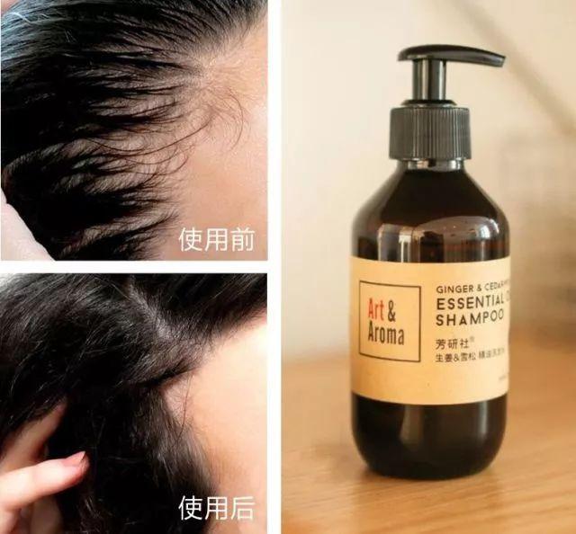 剃光头可以增加发量吗，剃光头增加发量可行吗（女博士剃光头研发精油洗发水）