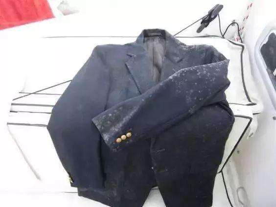 霉点用什么可以洗掉，羽绒服霉点用什么可以洗掉（翻出来的厚衣服有霉斑）