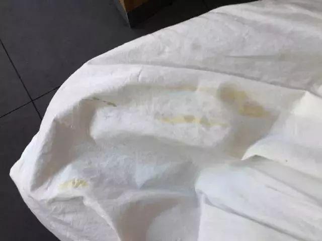 霉点用什么可以洗掉，羽绒服霉点用什么可以洗掉（翻出来的厚衣服有霉斑）