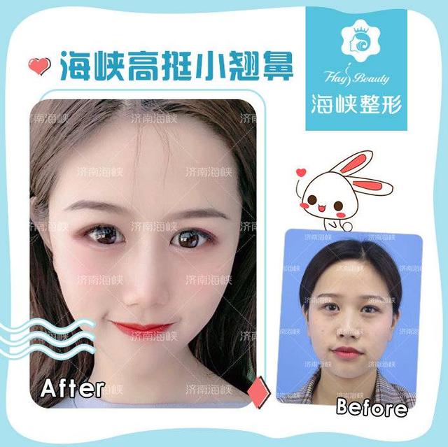 鼻子短怎么办，鼻子短怎么办适合什么发型（鼻子过短怎么整）