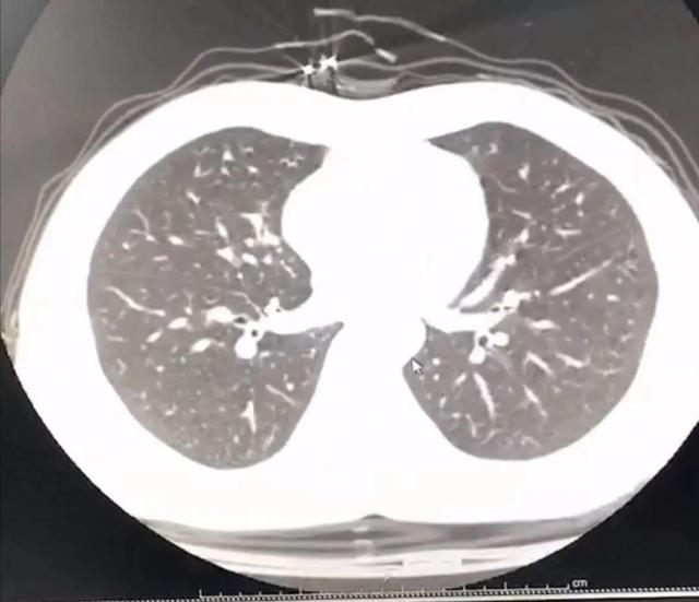 问美胶囊效果怎么样，问美胶囊销售热线（疑似感染新型肺炎）