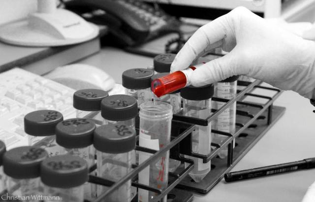 传染病八项包括什么，传染病八项检查什么（新冠疫情下重新认识的“术前传染病检测”）