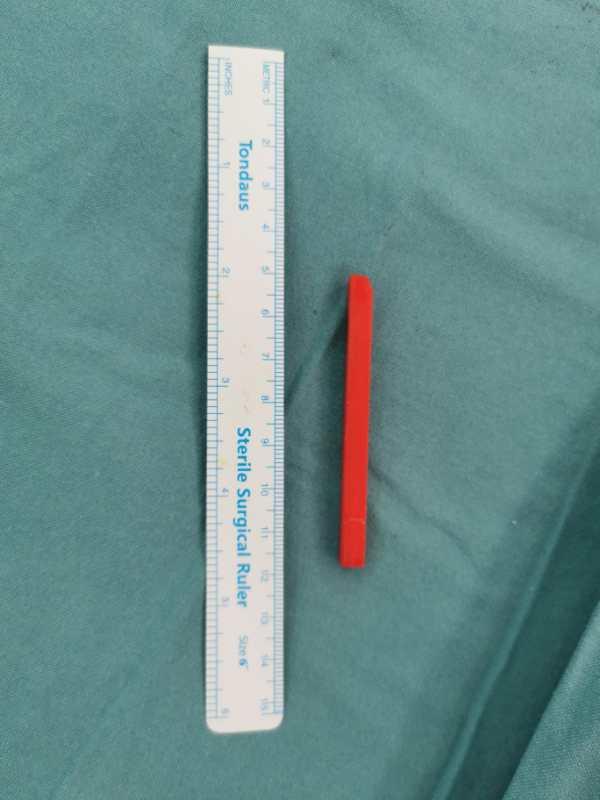 731部队活体解剖，731部队活体解剖打不打麻药（一男童摔倒筷子插入颅脑5厘米深）