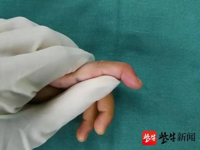 六亲不认的步伐，走出了六亲不认的步伐是什么意思（3位小朋友在病房走出“六亲不认的步伐”）