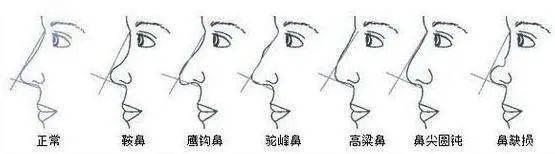 鼻子短怎么办，鼻子短怎么办适合什么发型（鼻子过短怎么整）