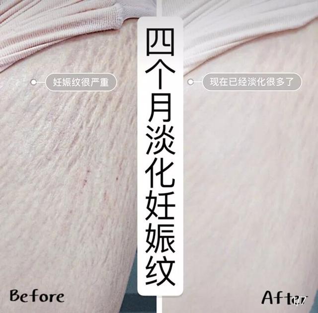 裸氨是什么面料，裸氨是什么面料优缺点（夏天穿它立马“冰冰凉”）