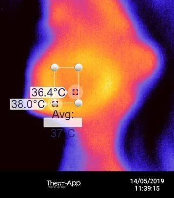 嘴角有皱纹怎么办，嘴角有皱纹怎么办呢（长皱纹了，怎么办）