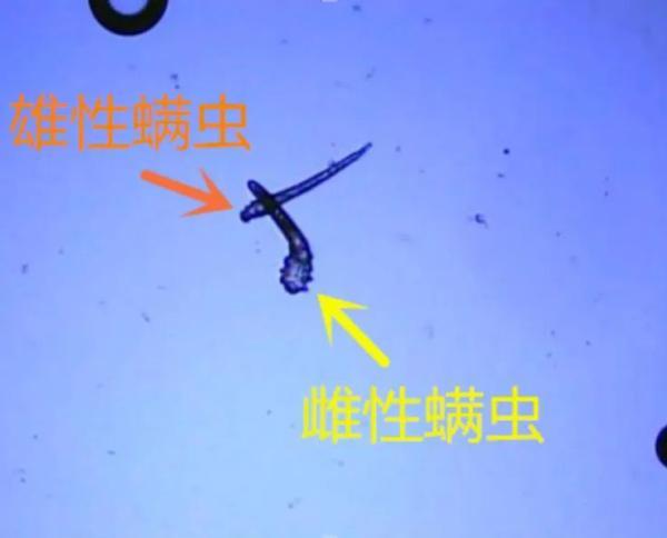 床上螨虫咬的症状图片，螨虫叮咬后的症状图（三根睫毛里竟揪出17条虫）