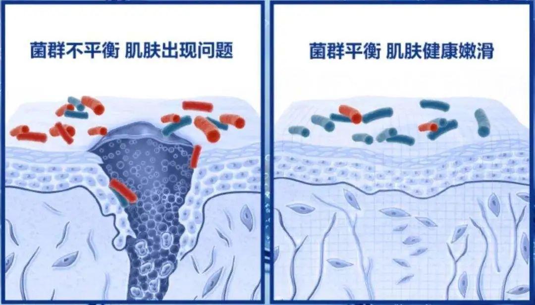 ahc是什么品牌，ahc是什么牌子（不到300，搞定秋敏肌肤作妖）