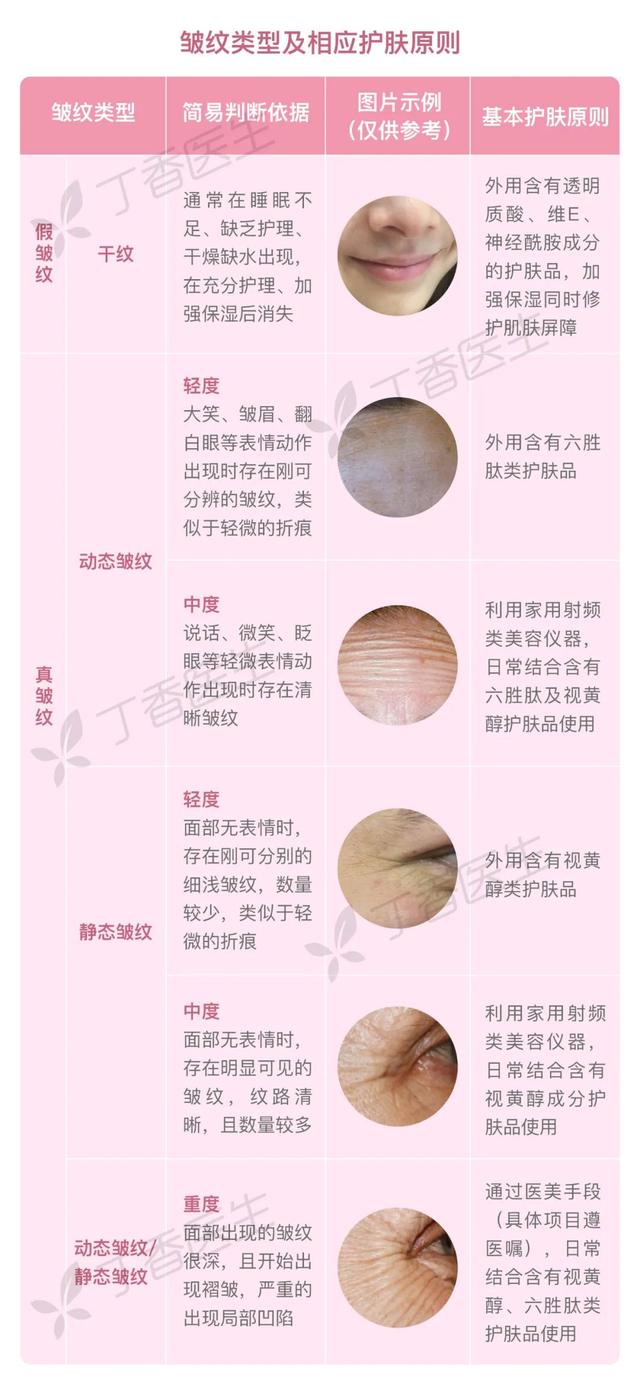 嘴角有皱纹怎么办，嘴角有皱纹怎么办呢（长皱纹了，怎么办）