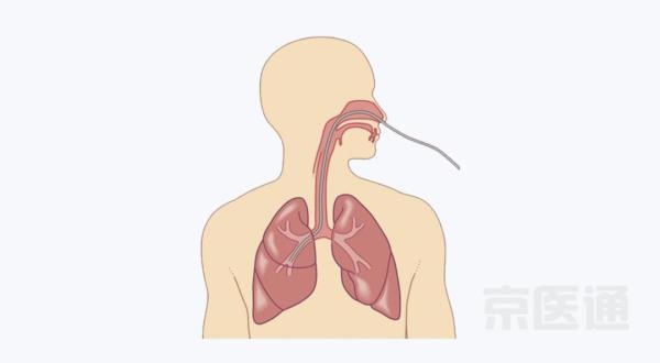 鼻内镜是怎么检查的，小孩腺样体肥大怎么检查（胃镜、肠镜、鼻镜……一文读懂内镜检查）