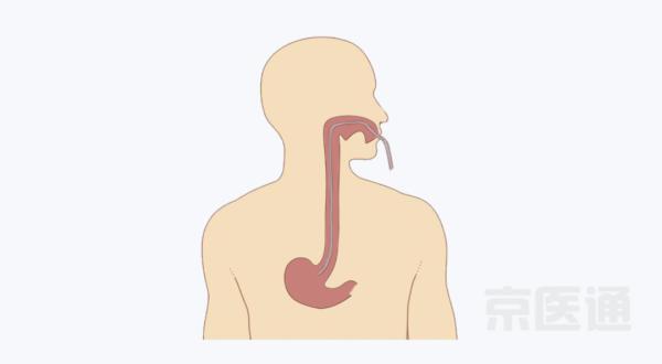 鼻内镜是怎么检查的，小孩腺样体肥大怎么检查（胃镜、肠镜、鼻镜……一文读懂内镜检查）