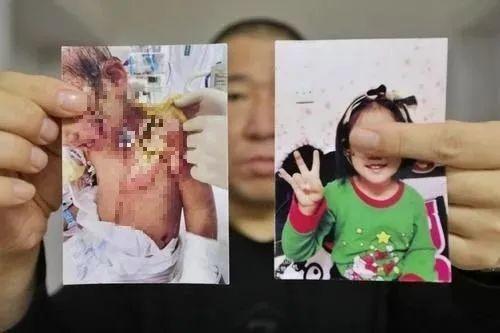 小姑娘打一字，小姑娘打一字打一成语（热水浇头、钳子拔牙……6岁女孩惨遭亲妈及其男友虐待）