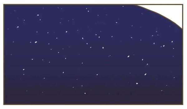 有头皮屑是什么原因引起的，很多头皮屑是什么原因（健康的人，会有头皮屑吗）