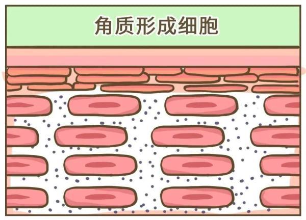 有头皮屑是什么原因引起的，很多头皮屑是什么原因（健康的人，会有头皮屑吗）
