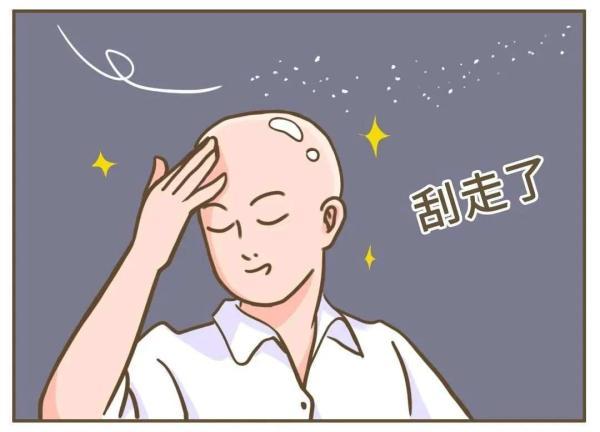 有头皮屑是什么原因引起的，很多头皮屑是什么原因（健康的人，会有头皮屑吗）