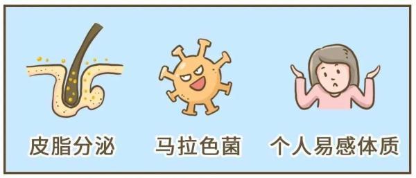 有头皮屑是什么原因引起的，很多头皮屑是什么原因（健康的人，会有头皮屑吗）