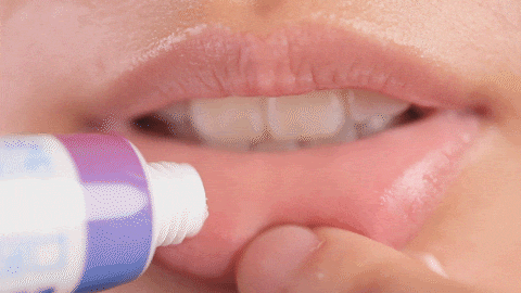 口里长溃疡怎么办，口腔溃疡怎么办（除了等它自己好）