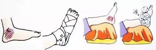 冰敷消肿一般要多久，消肿需要多久（到底是热敷还是冰敷）