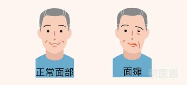 躁动不安什么意思，烦躁不安的意思（烦躁不安的意思造句）