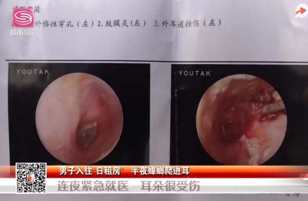 人睡着了蟑螂会咬人吗，如何让蟑螂不靠近床（更恐怖的是蟑螂有个不为人知的偏好……）