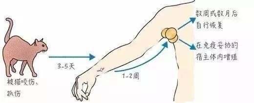 养猫女孩颅内有大量寄生虫，幼猫一定要跟人睡,不然就一直叫（这种病全球每年发病人数超过4万例）