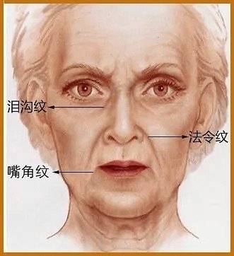 面部纹路图解,什么是木偶纹-相术-荣耀易学