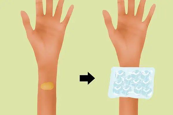 不正常淤青图片，身体无缘无故淤青是怎么回事（或许与这些原因有关系，别忽视）