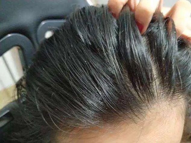 怎样让头发柔顺，怎样让头发更柔顺（洗头时牢记“4不要”）