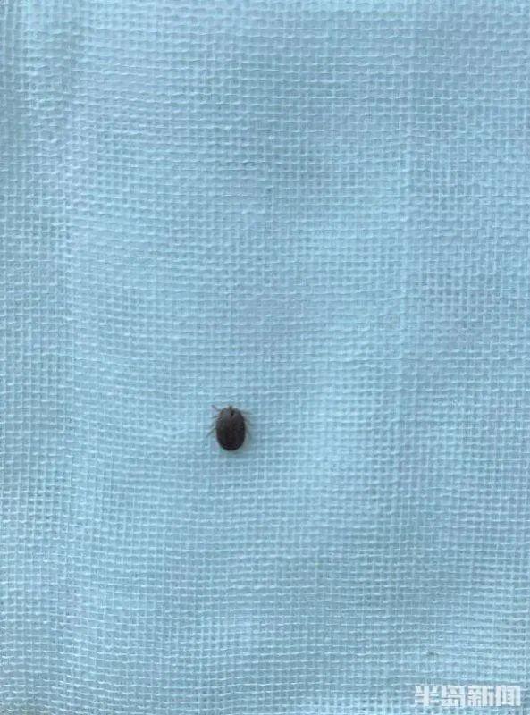 后脑勺长包图片，后脑勺长包是怎么回事（结果发现一个“黑点”）