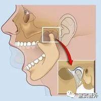 磨牙症的症状和危害，睡觉磨牙？你中招了吗