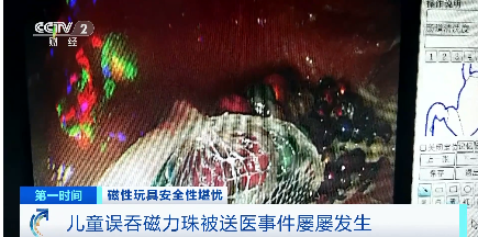 磁力球对身体有害吗，磁力球对孩子有影响吗（五岁儿童误吞190颗磁力珠）