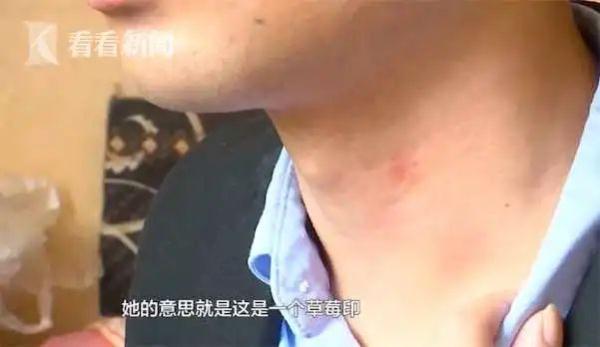 草莓印的危害是什么，草莓印有危害嘛（女友认定是吻痕要分手）