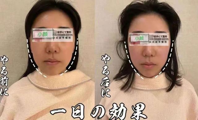 多久做一次背部擀筋，身体擀筋多久做一次（扬州这家养生馆要被约爆）