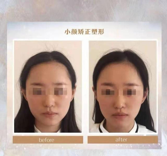 多久做一次背部擀筋，身体擀筋多久做一次（扬州这家养生馆要被约爆）