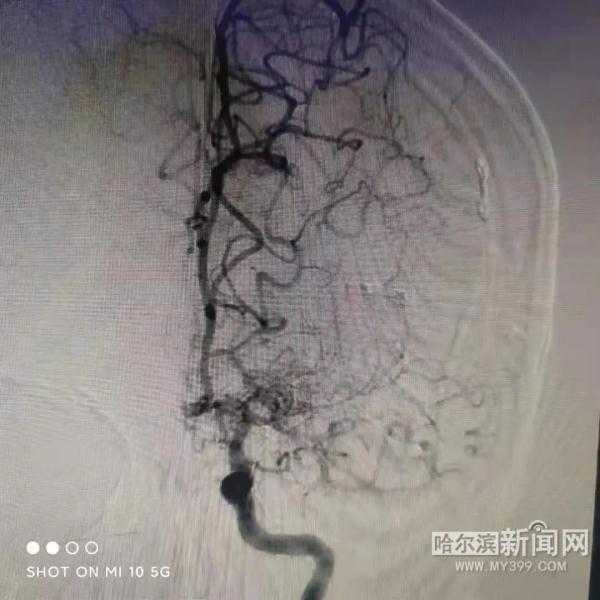 梦到瘫痪已久的老人突然好了，梦见瘫痪的人好了是什么意思（医生一查：脑袋里“少根儿筋”）