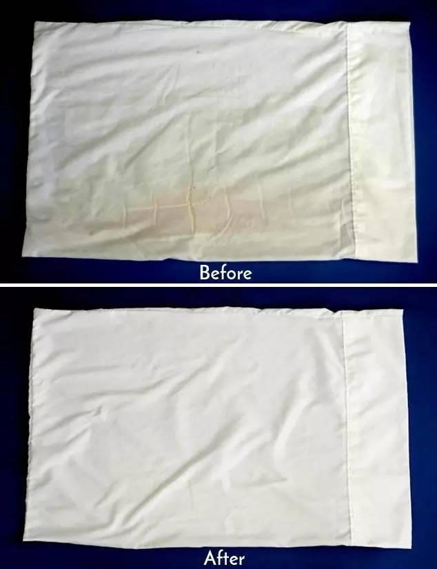 白色衣服发黄了怎么可以洗白，衣服发黄怎么洗白小妙招（白色衣服总是发黄、洗不干净）