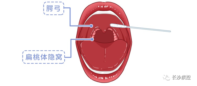 去采耳店采耳安全吗，采耳有危险吗（核酸检测为什么要采口鼻）