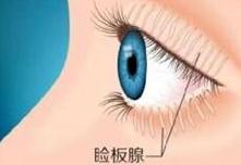 这几种常见的“眼疾”！，眼部疾病有哪些?症状是什么（都是因这个很多人都有的眼病而起）