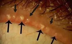 这几种常见的“眼疾”！，眼部疾病有哪些?症状是什么（都是因这个很多人都有的眼病而起）