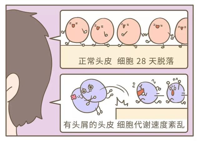 去屑还止痒，这款宝藏洗发水藏不住了