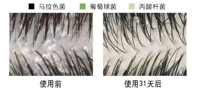 去屑还止痒，这款宝藏洗发水藏不住了