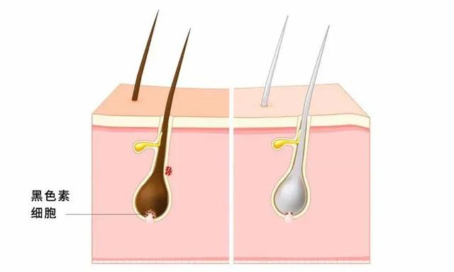 头发变白的原因，头顶头发变白的原因（“白头发”可能预示这些疾病）