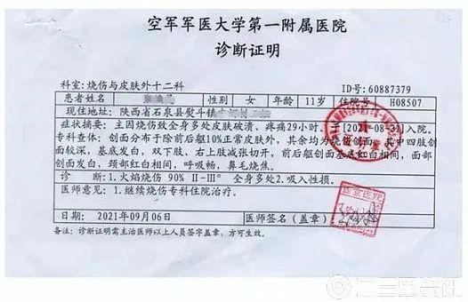 甲醇爆炸有毒吗，甲醇有爆炸性吗（全身90%被烧伤…孩子想继续跳舞）