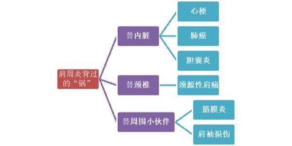 肩膀疼是怎么回事，我左肩膀疼是怎么回事（背后可能隐藏数十种疾病→）