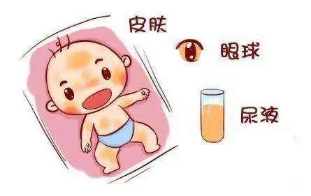 新生儿黄疸的原因，新生儿黄疸的原因是什么（十个宝宝九个“黄”）