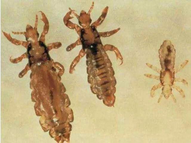 虱子卵长什么样，虱子卵（30年前农村人人都长的虱子）