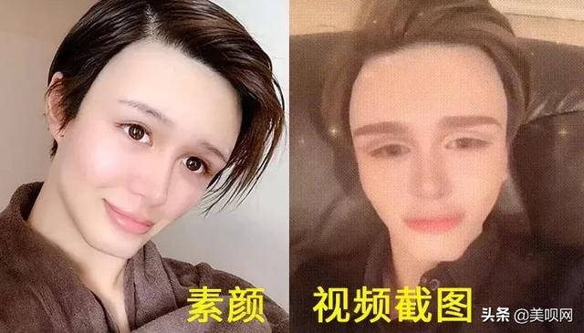刘梓晨面部填充，日本星二代突变刘梓晨同款“蛇精脸”