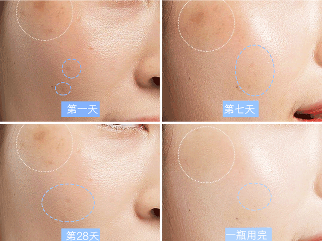 377美白精华，野城医生377vc美白精华怎么用（美白精华大盘点 ）